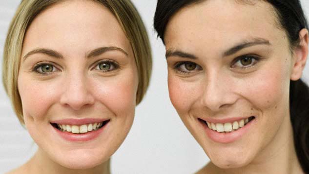 Acne tardia, na idade  adulta. 