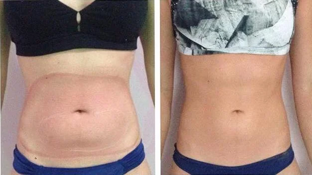 Antes e Depois Foto : Edilamar Beauty 