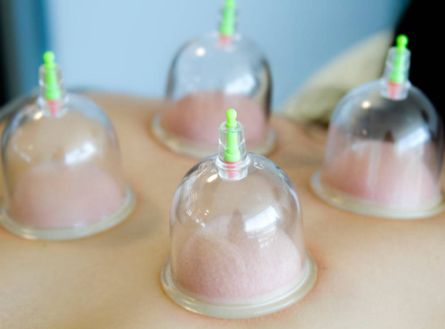 Cups in place on the skin