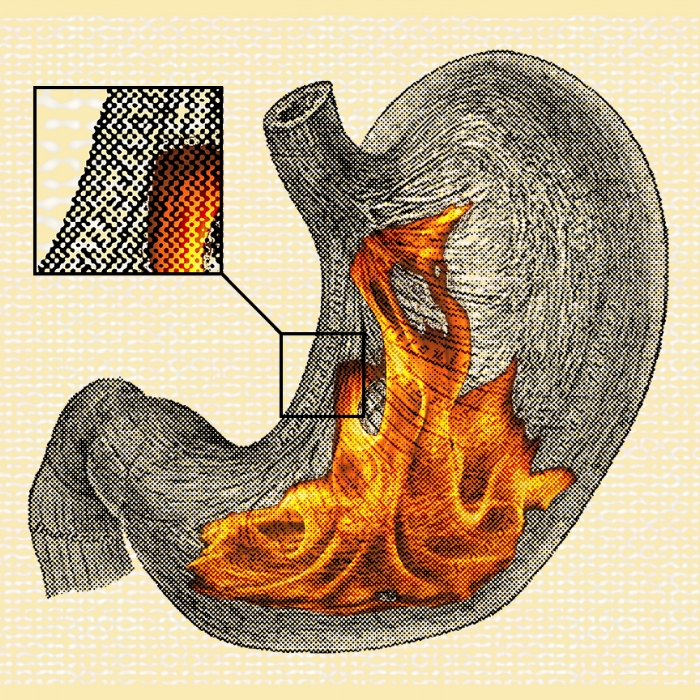 24/100: I got a fire in my belly.