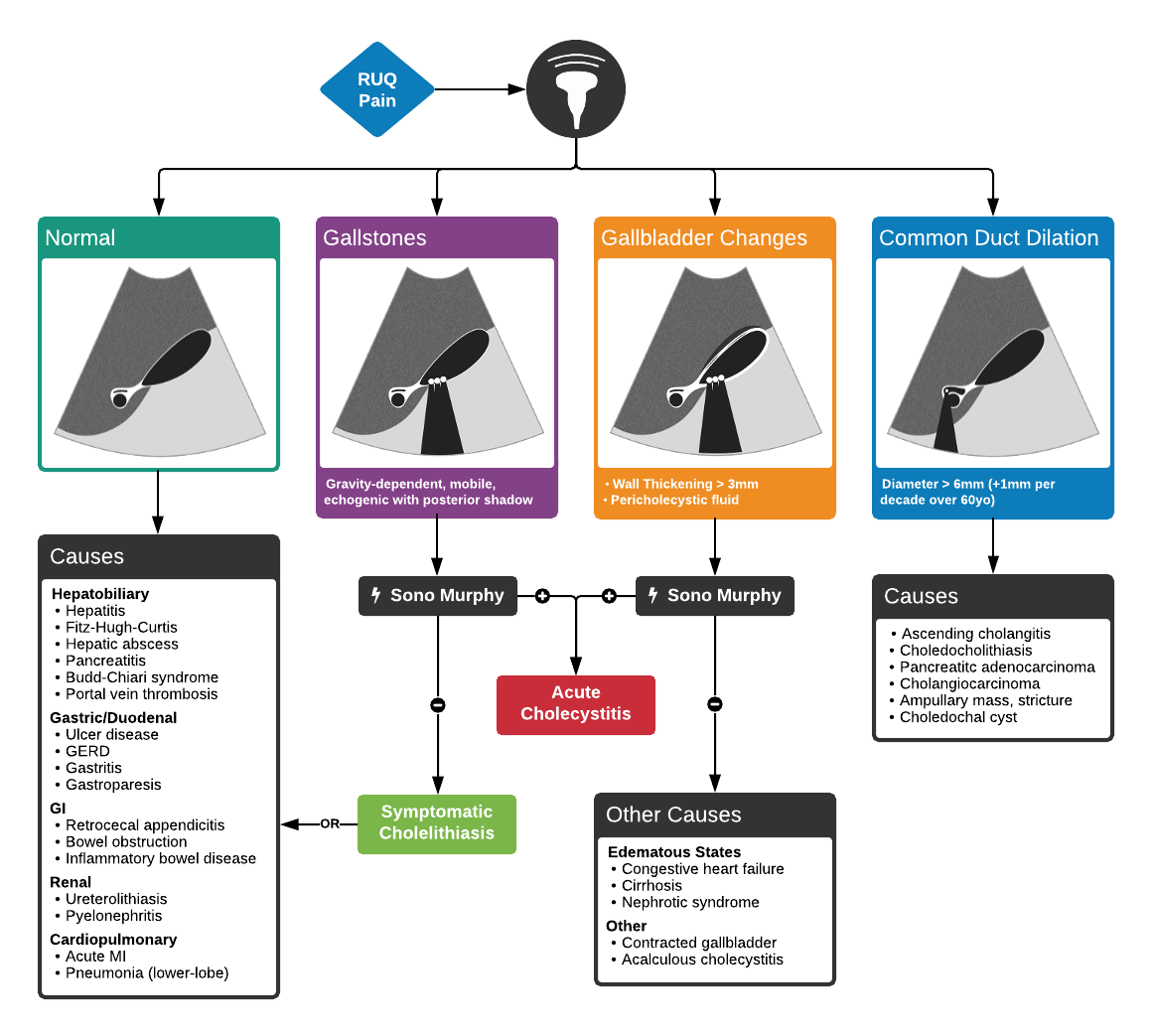 Full ddxof.com article and algorithm on Hepatobiliary Ultrasound can be found at https://ddxof.com/hepatobiliary-ultrasound/