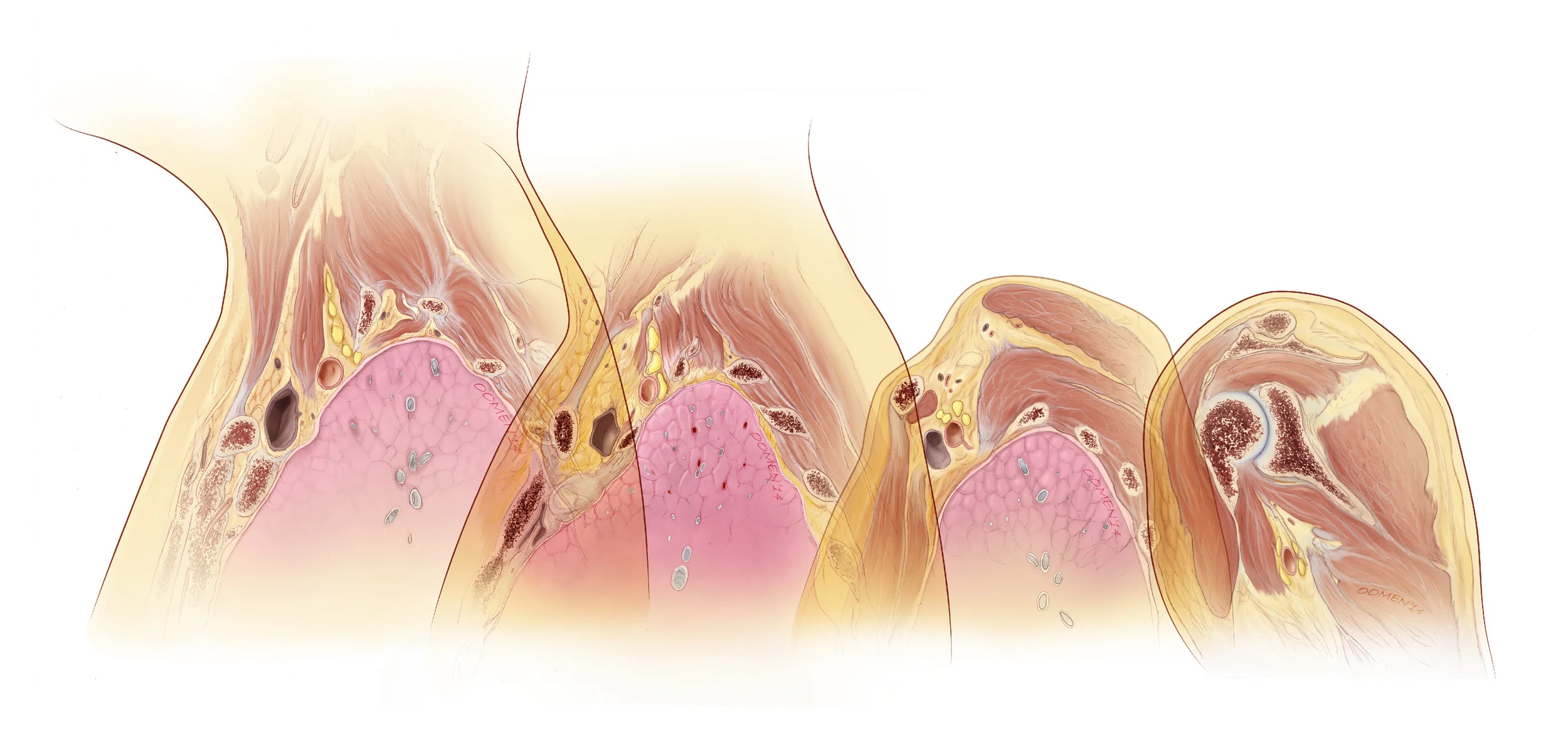 Brachial Plexus comp.jpg