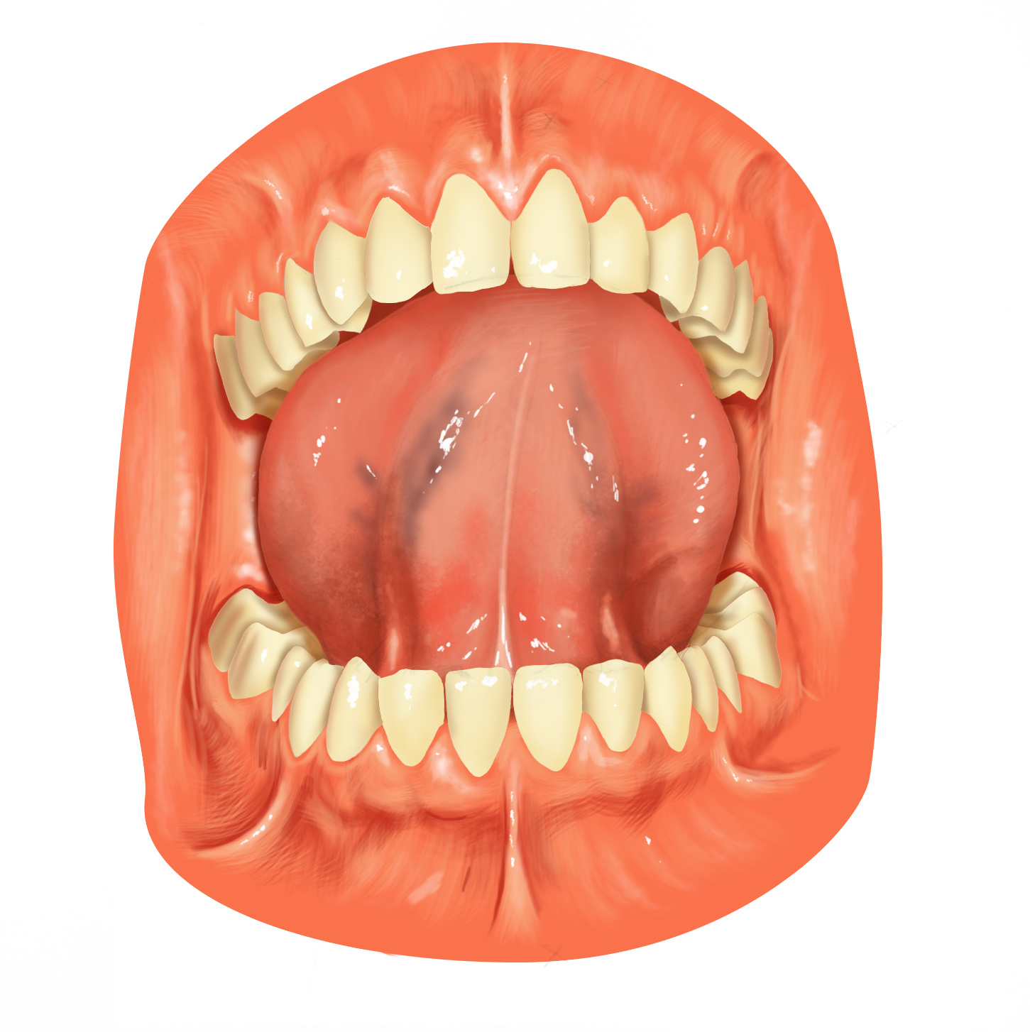 Intraoral Anatomy
