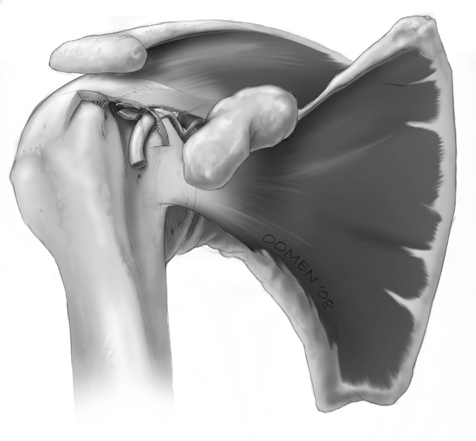 Biceps tendon