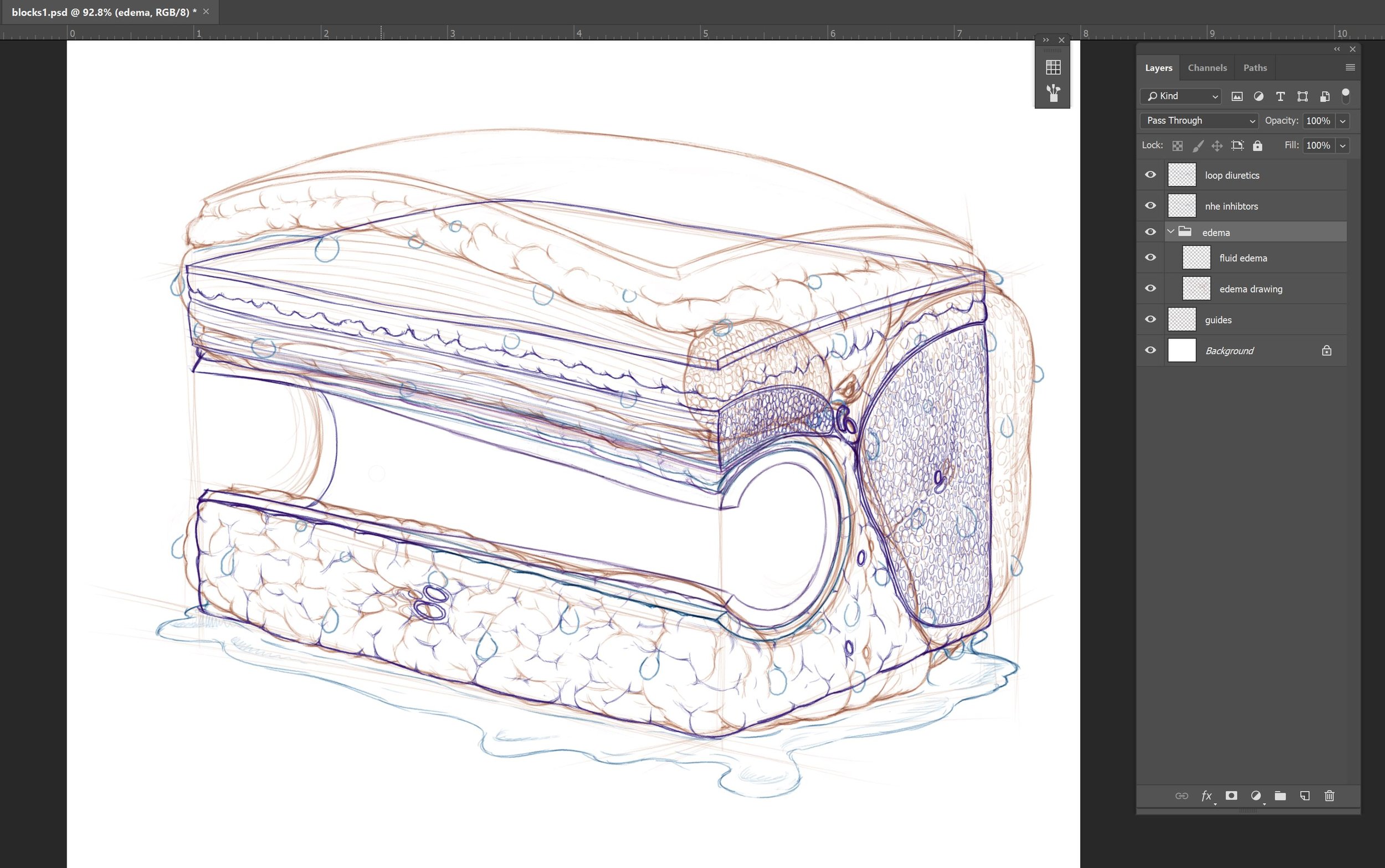 This is the working document for this image so far. As I mentioned above, the coloured pencil allows me to tell which layer I'm working on. This will get sorted out when I start to render the image in final. Also, the edema layer has an extra layer …