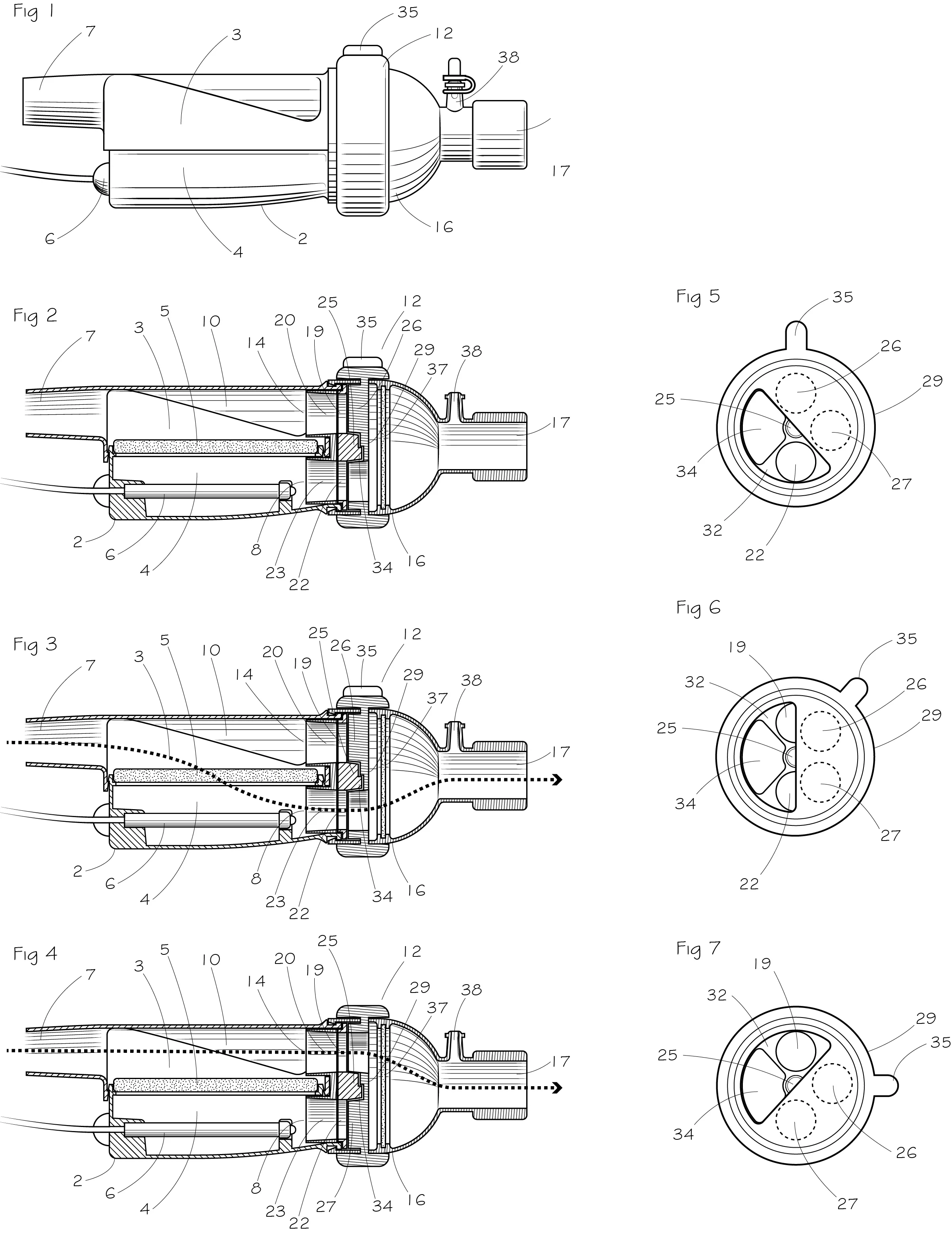 Bypass patent drawings v1.0.jpg