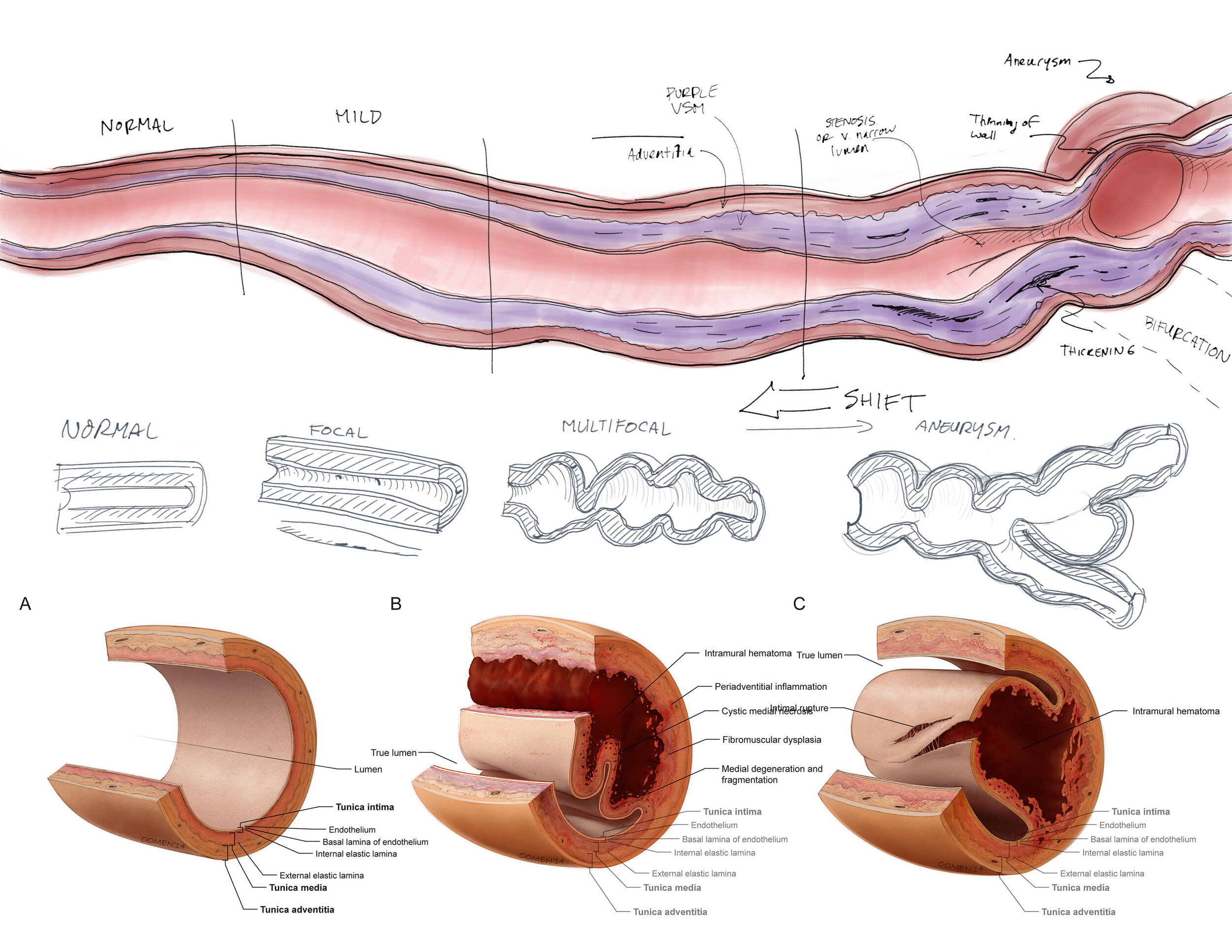 Establishing the major elements