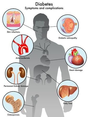 diabetes-symptoms (1).jpg