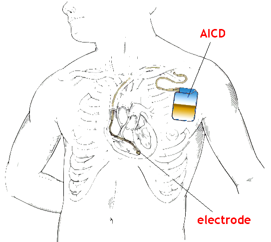 AICD.jpg