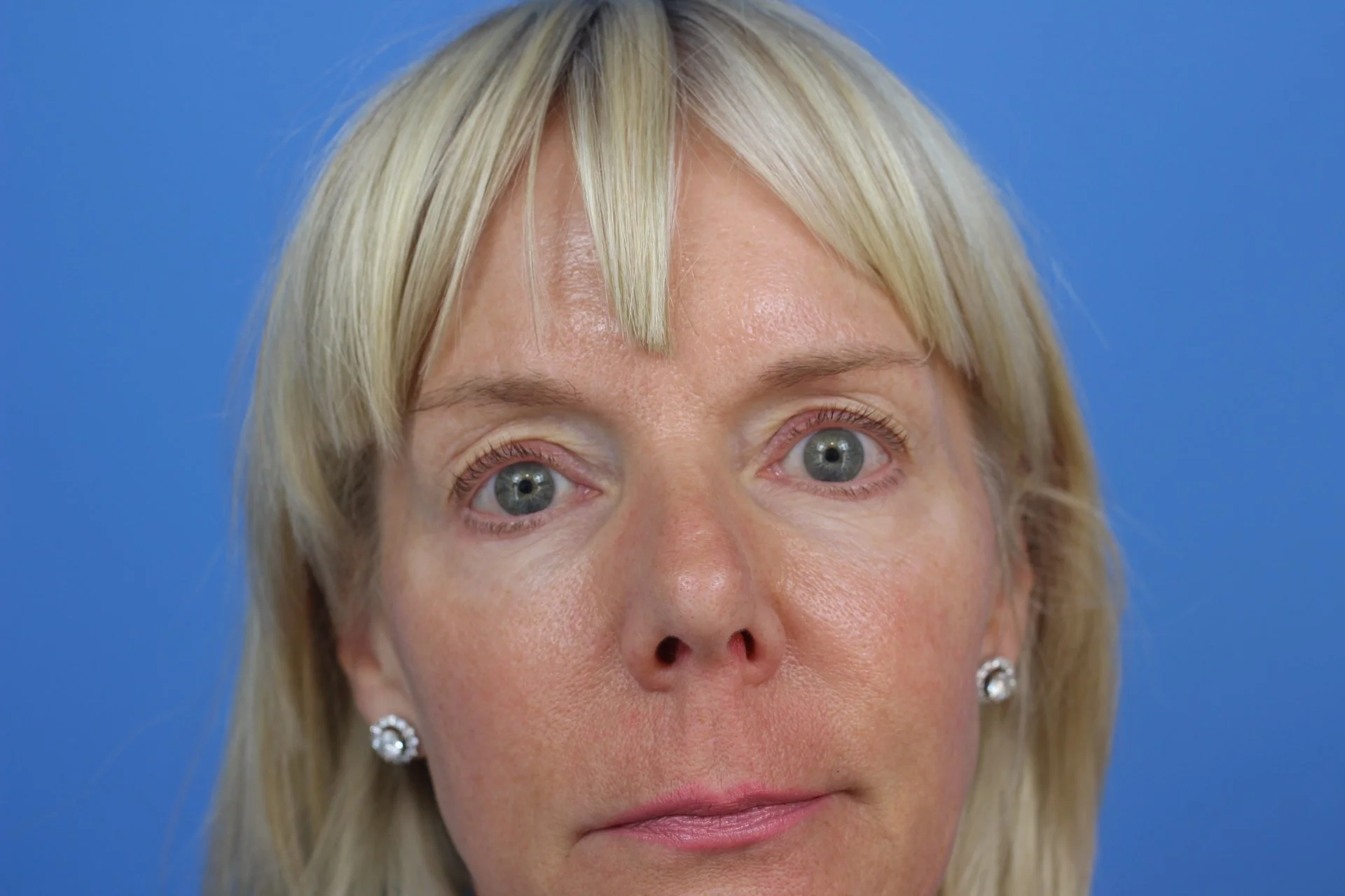 BELPH2 07072020.JPG
