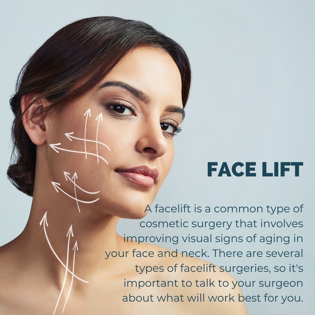 A facelift (also known as a rhytidectomy) is a general term for any surgical procedure that improves signs of aging in your face and/or neck by repositioning or removing skin, fat and/or muscle. 

Signs of aging that a facelift can restore include:
&