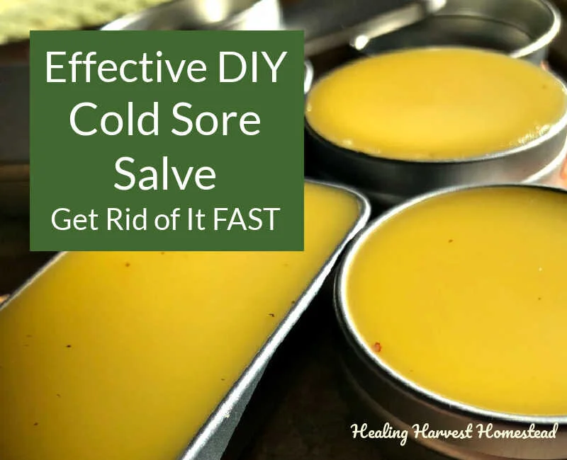 Cold Sore Salve Recipe With Lemon Balm And L Lysine Relieve Pain And Help Them Go Away Fast All Posts Healing Harvest Homestead