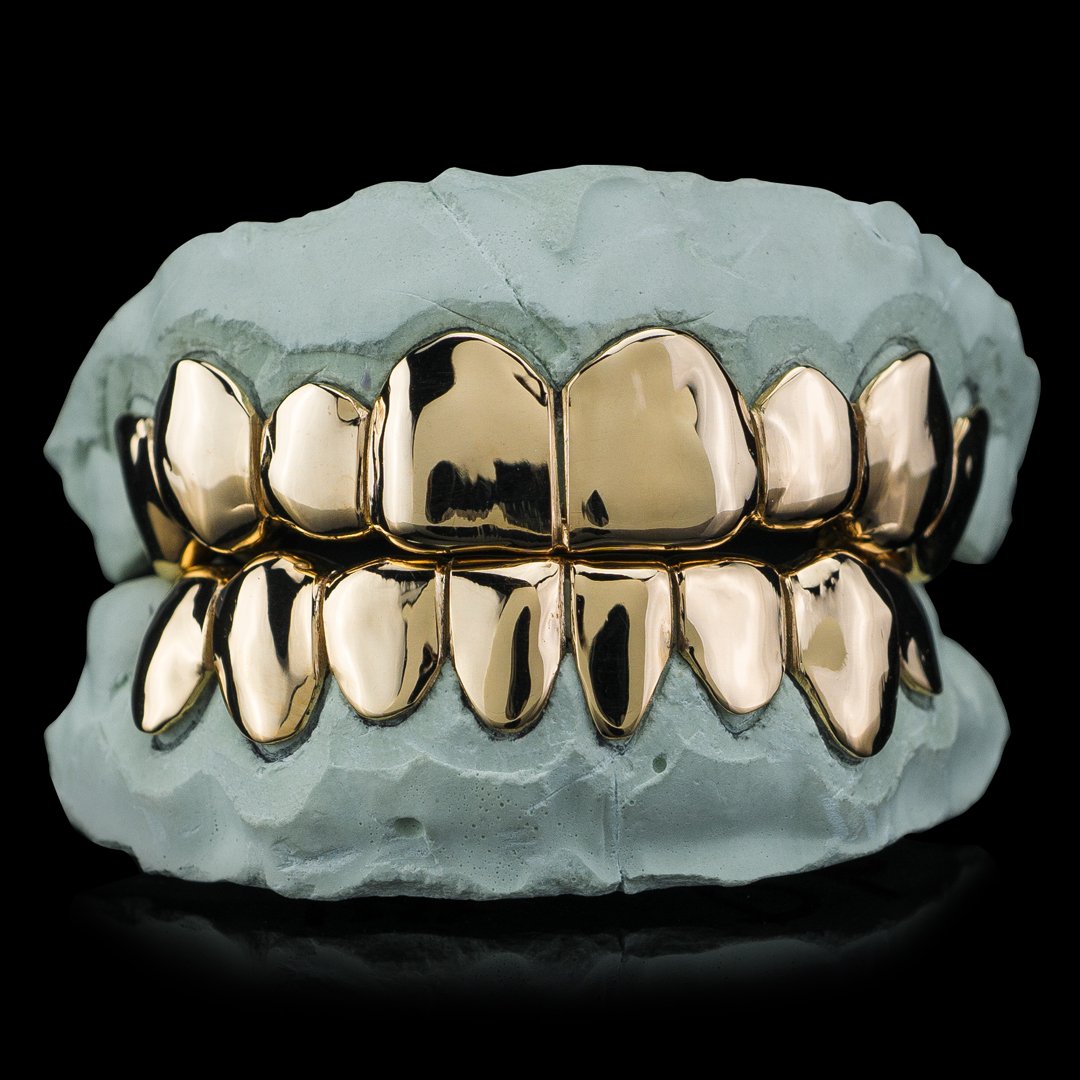Affordable Solid Gold Deep Cut Grillz.