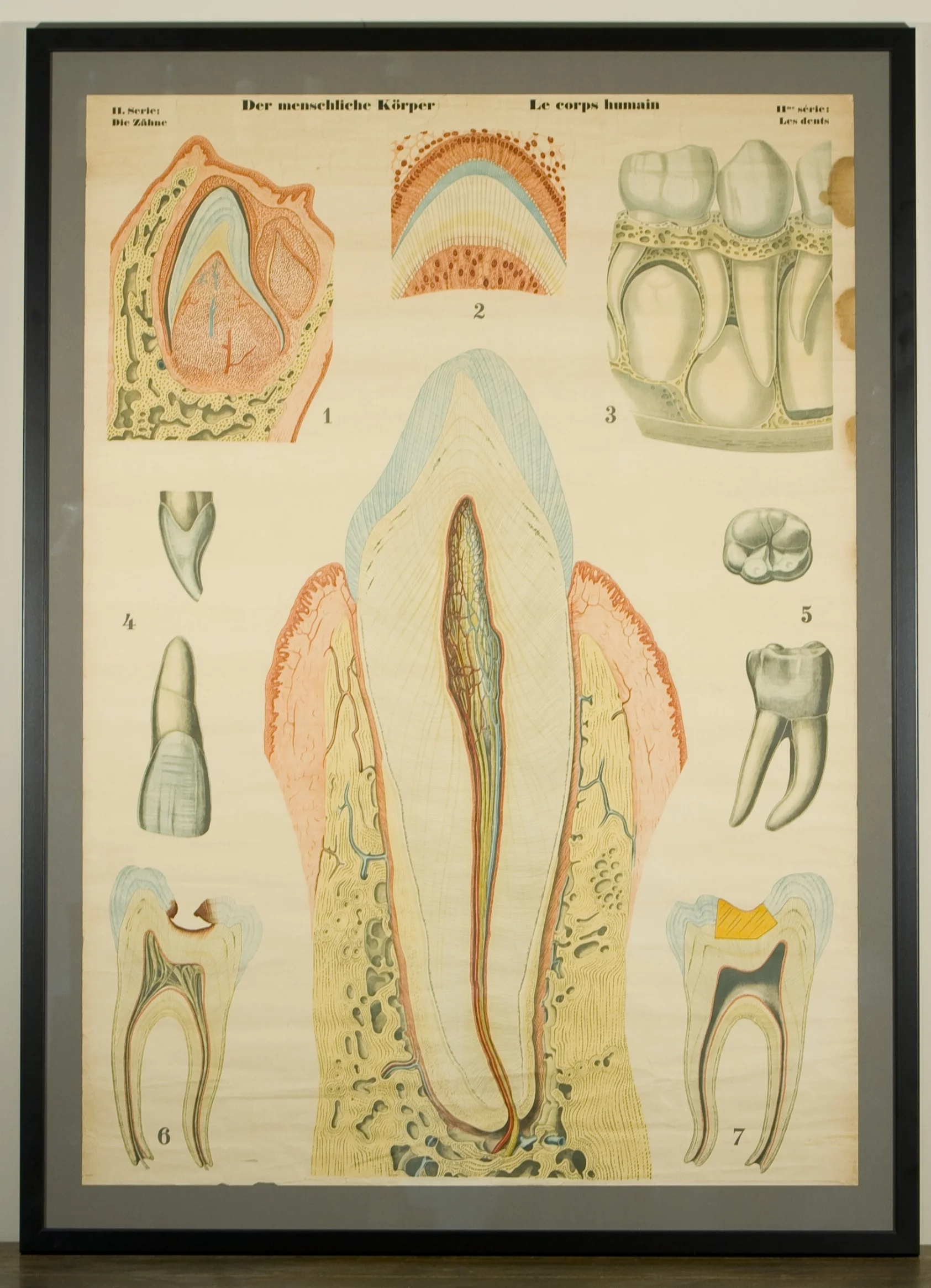 Vintage Framed Chart of Human Teeth