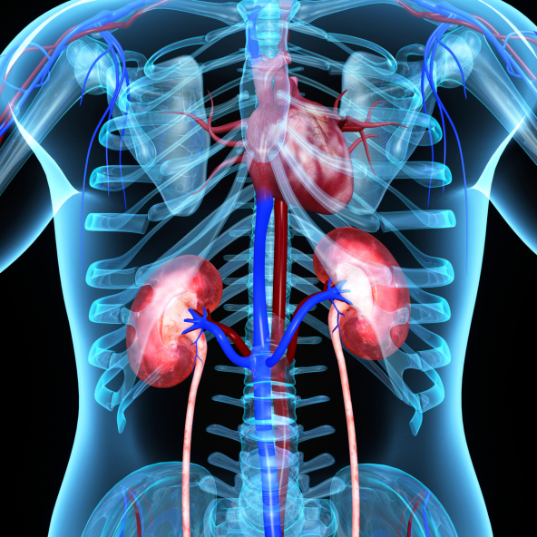 Can-kidney-stones-lead-to-heart-problems.jpg