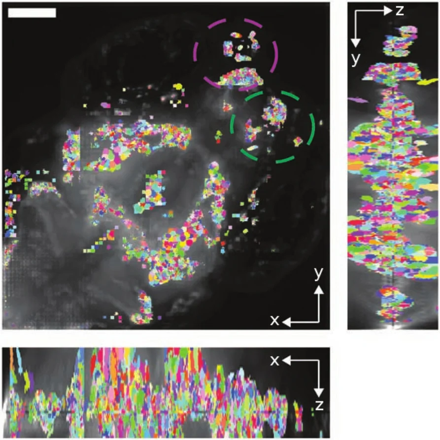 3D fluorescence imaging of the whole zebrafish brain in-vivo (from Prevedel 2014)