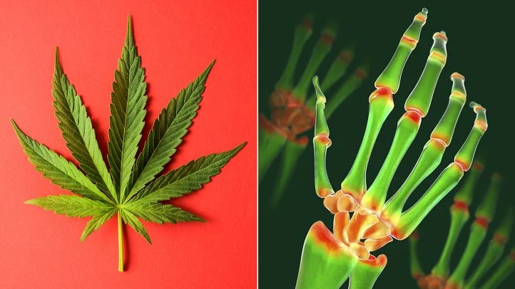 Cannabis and Pain