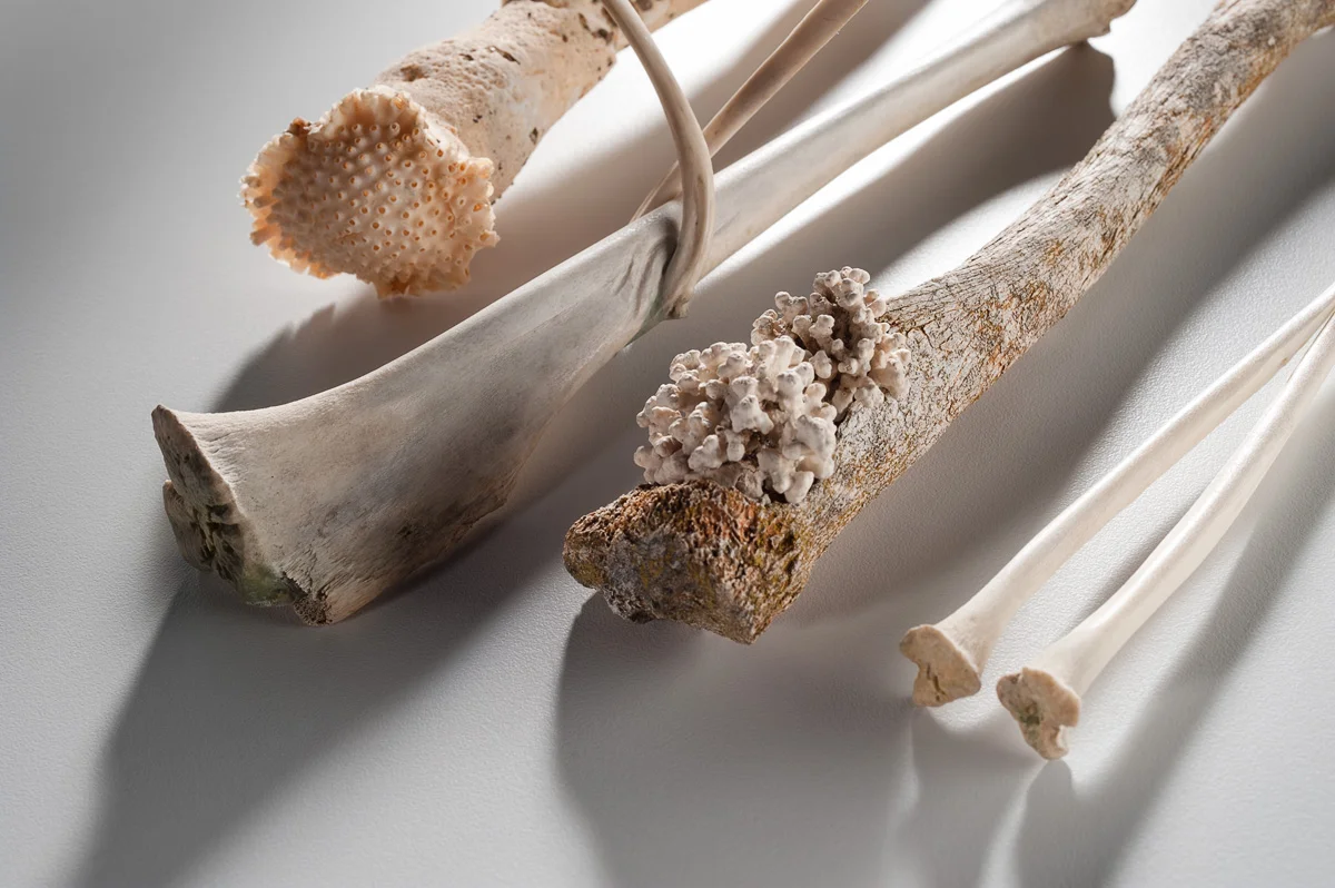 Long Bones Group