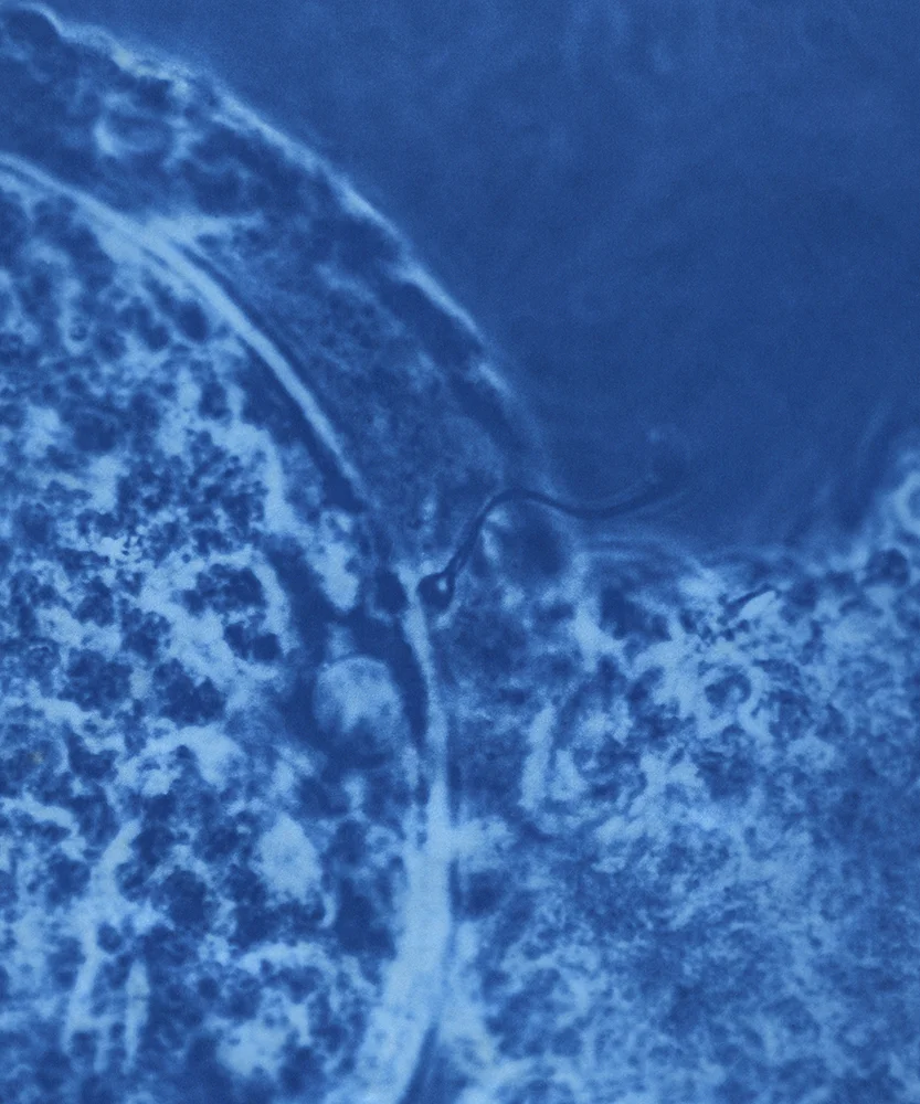 Oocyte with sperm