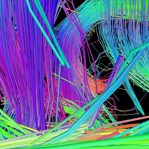 Human Connectome Project Diptych Detail 1