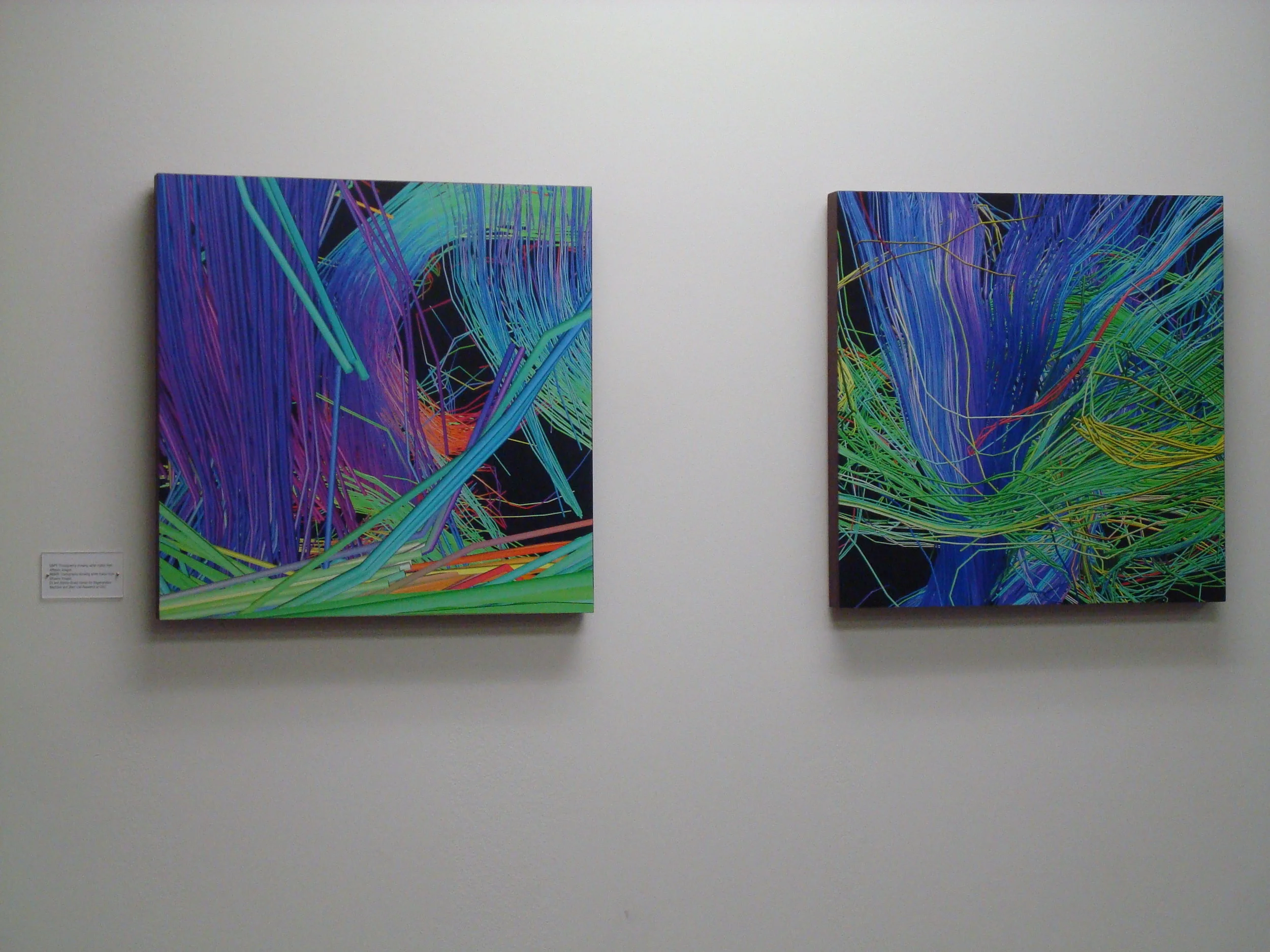 Human Connectome Project Diptych