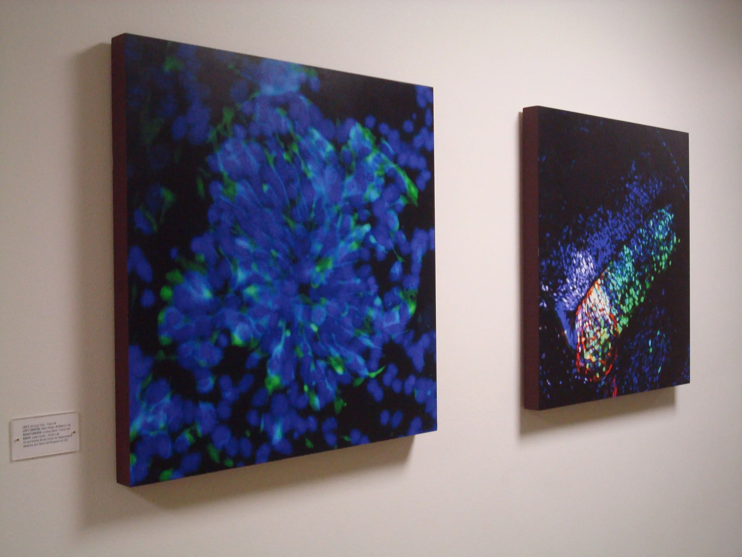 Stem Cell Series Left Side