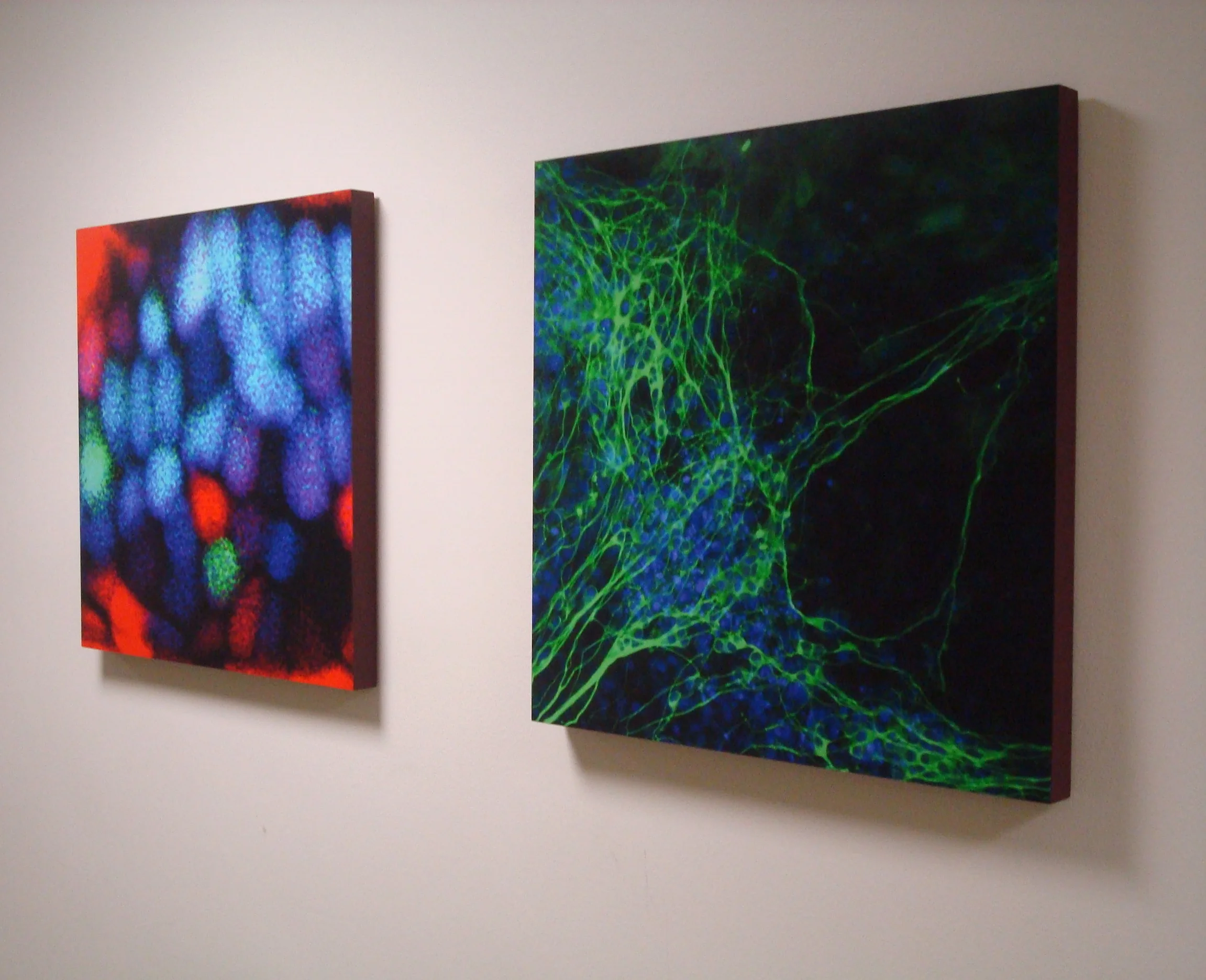 Stem Cell Series Right Side
