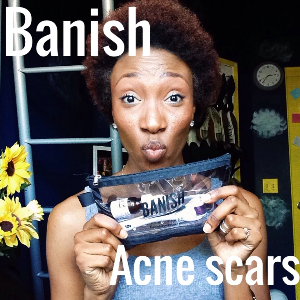 Banish Acne Scars - Review