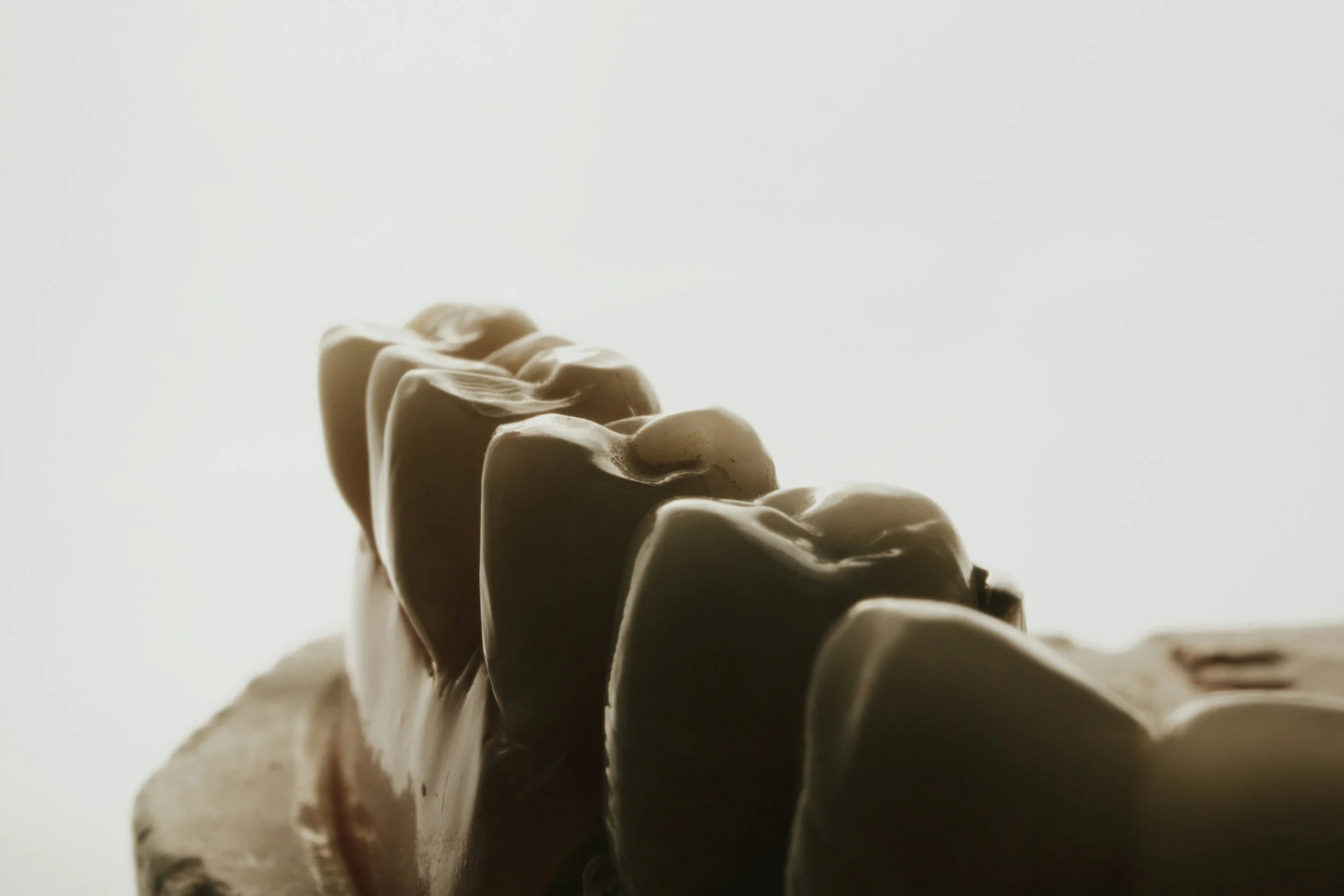 Are Full Mouth Dental Implants Right for You? Benefits, Considerations, and What to Expect