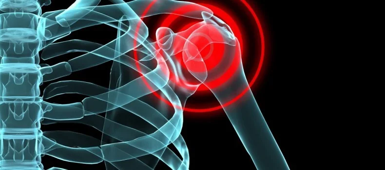 Does your shoulder hurt?