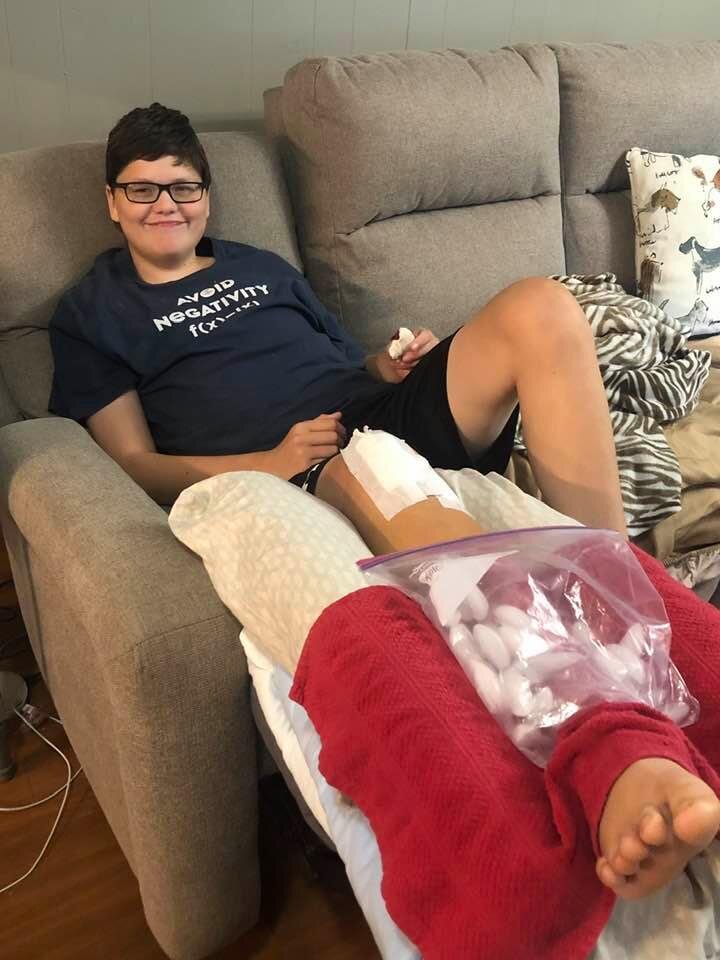 logna smith recovering at home after leg surgery july 2021.jpg