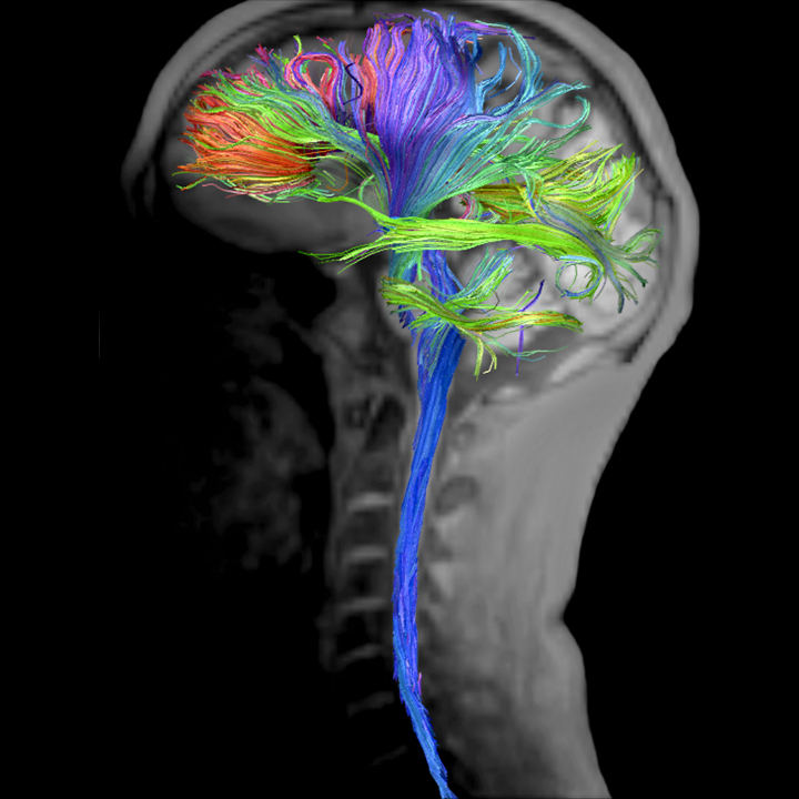 The Sense of Self in Posterior Cingulate