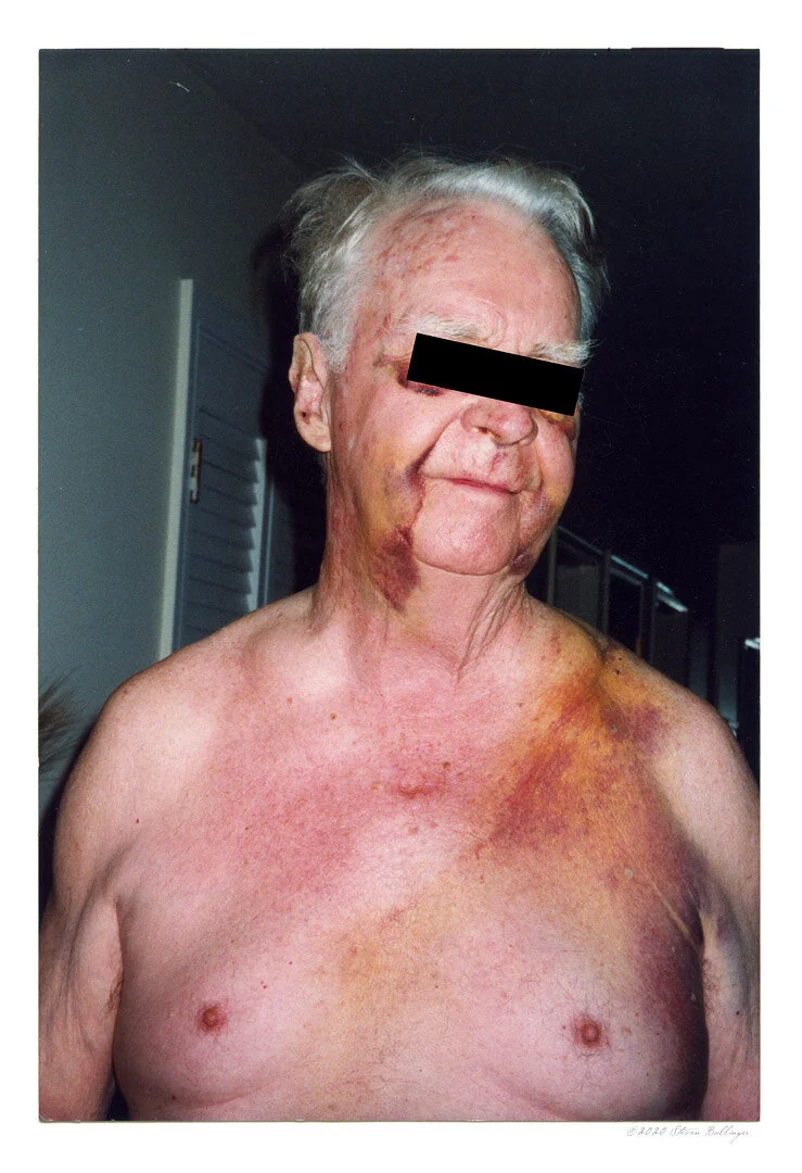 bruisedPRINT.jpg