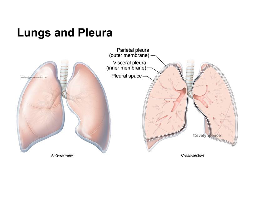 Pleura.jpg