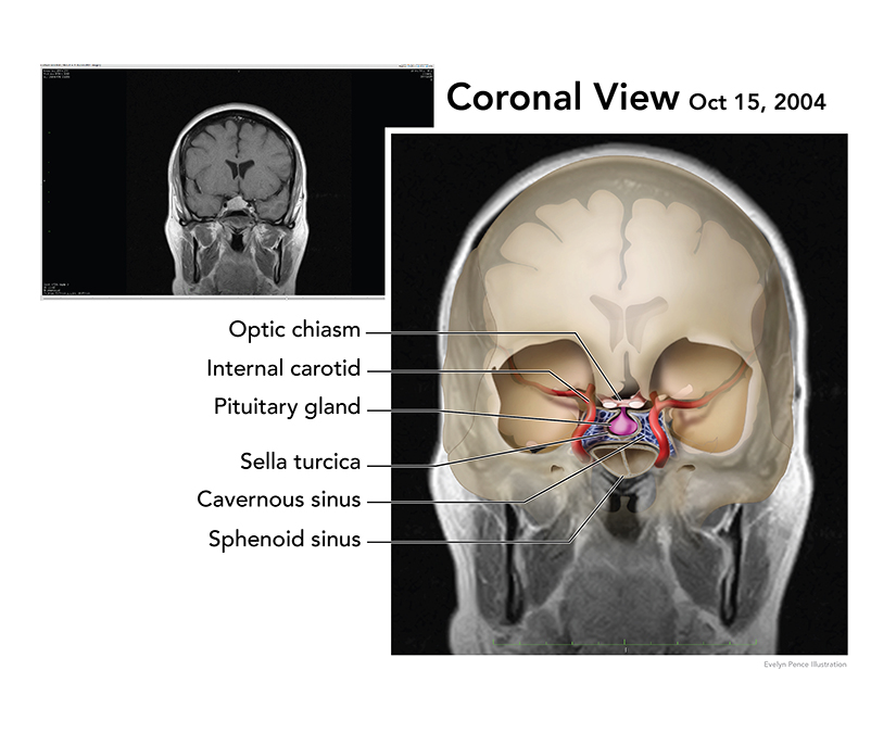 Coronal.jpg