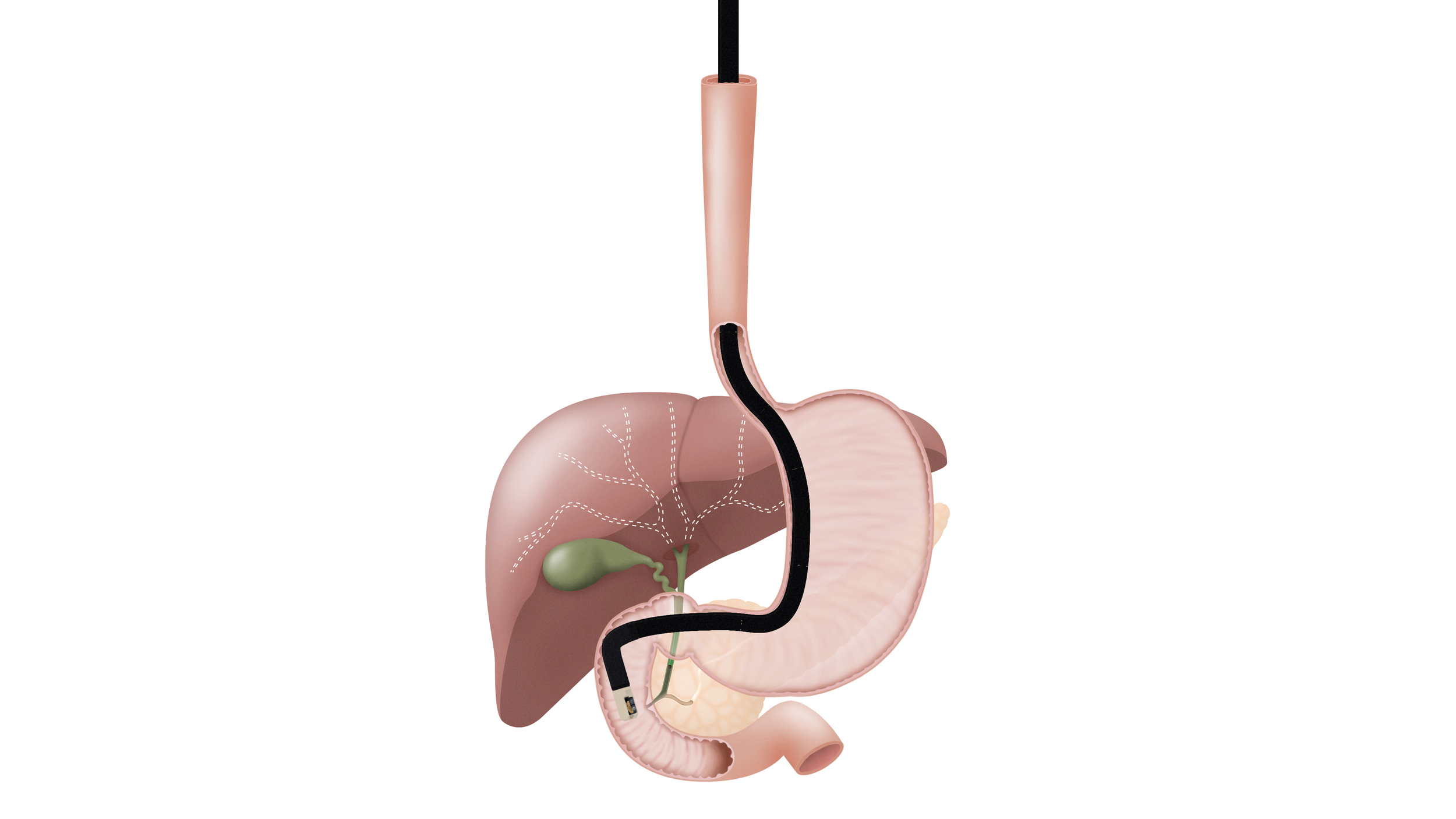 PENTAX - Endoscope - Full Anatomy.png