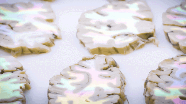 SCALE: Brain - Slices.gif