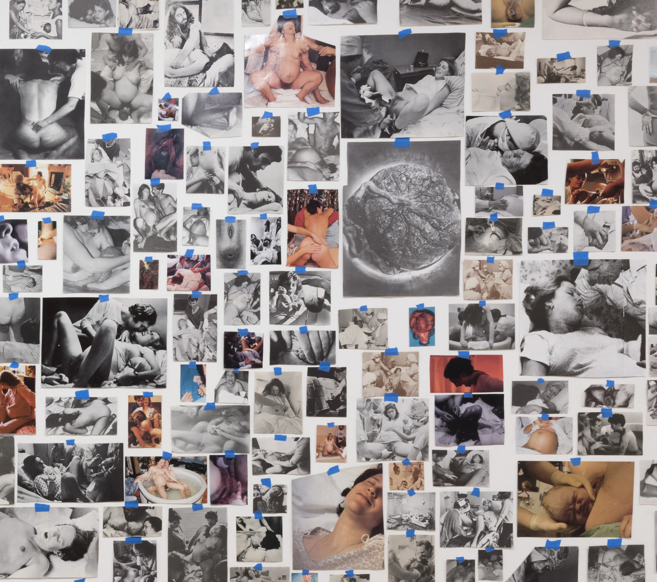 Detail from Carmen Winant, My Birth , 2018.