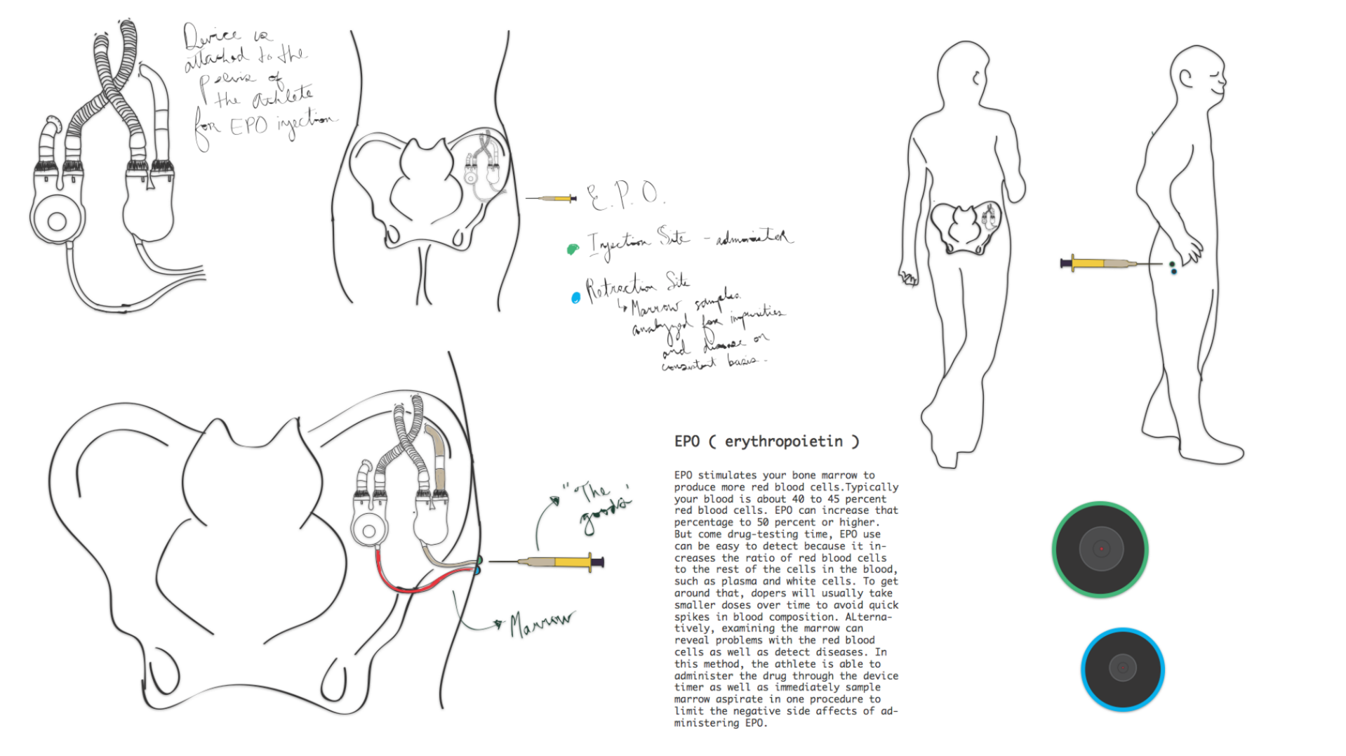 EPO Injection 