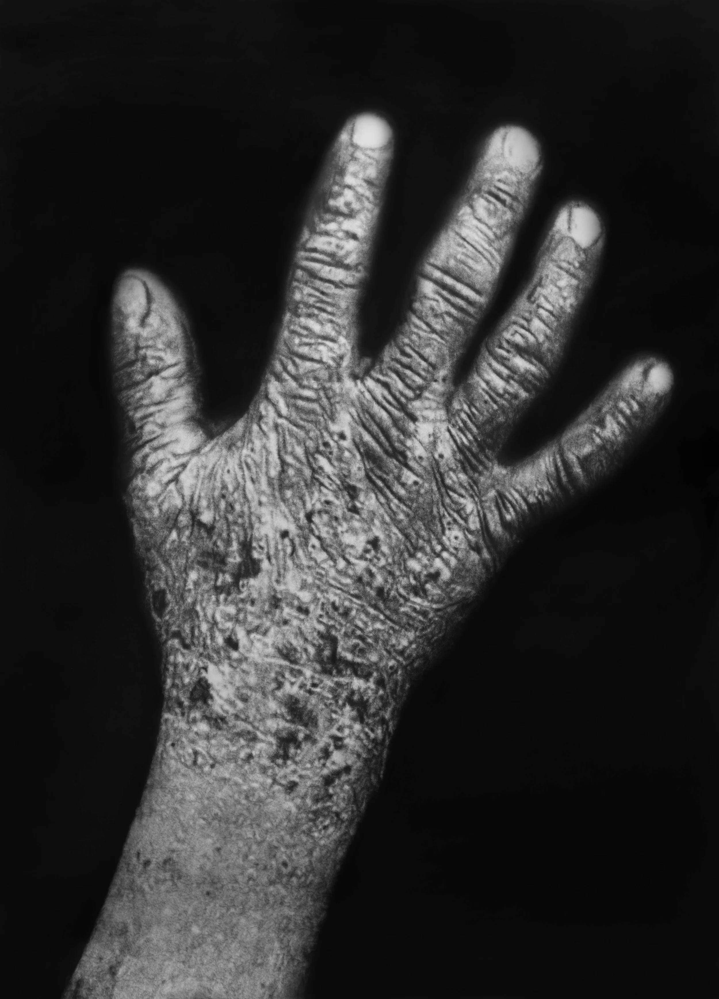Éric Manigaud, "Dartres", 143 x 192 cm, 2014