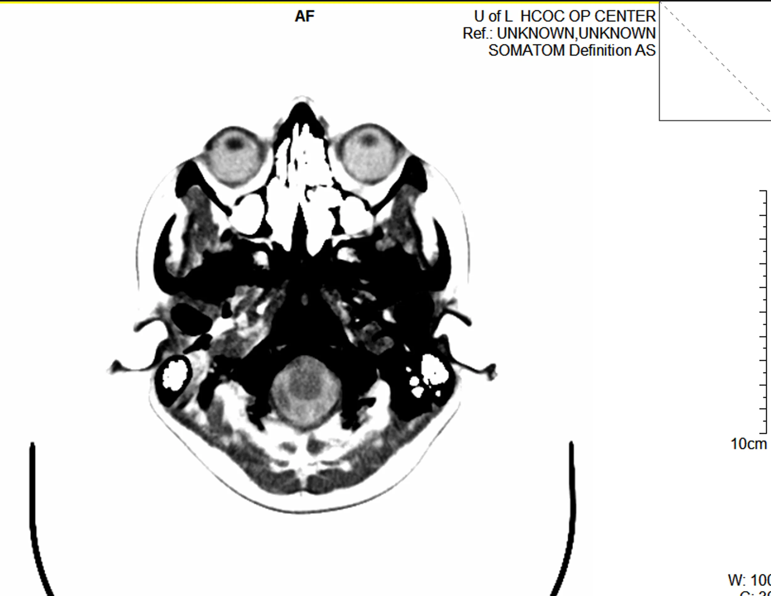 brain scan.jpg