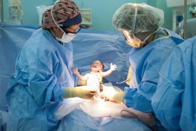 c-section-e1427221286829.jpg