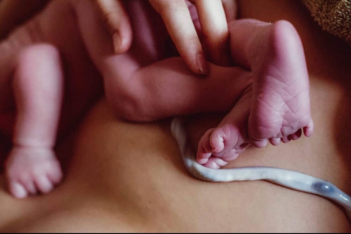 Skin to skin 💛🔆

&bull;
&bull;
&bull;
#umbilicalcord #skintoskin #microbiome #newborn #birthphotography #doula #waitforwhite #cordblood #midwife #studentmidwife