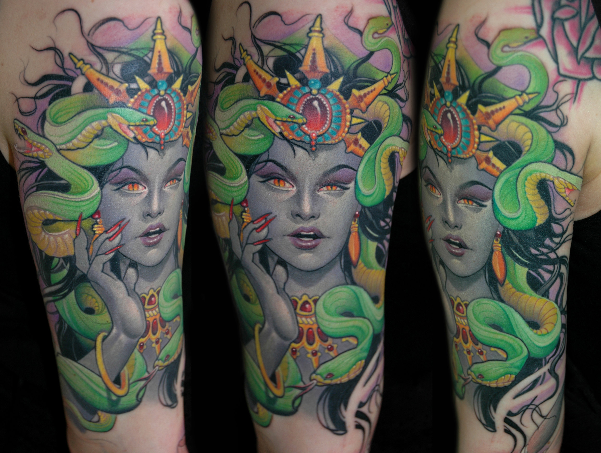 MEDUSA