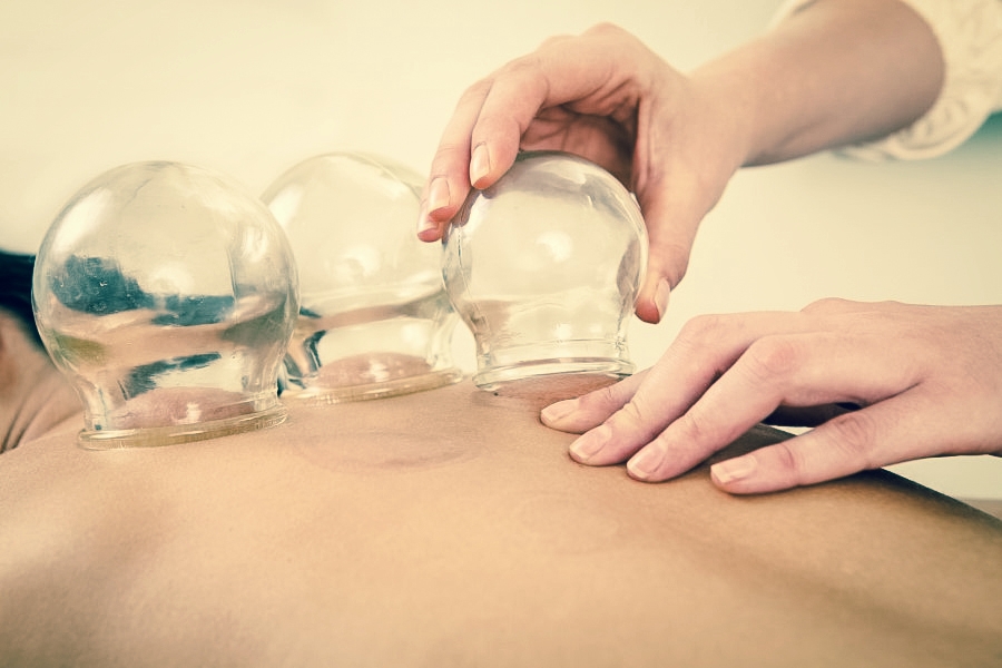 Cupping.jpg