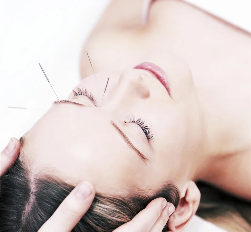 acupuntura-facial.jpg