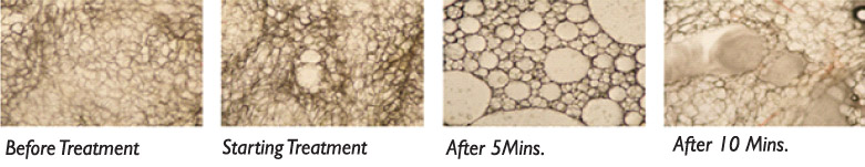 Breaking Fat Cells