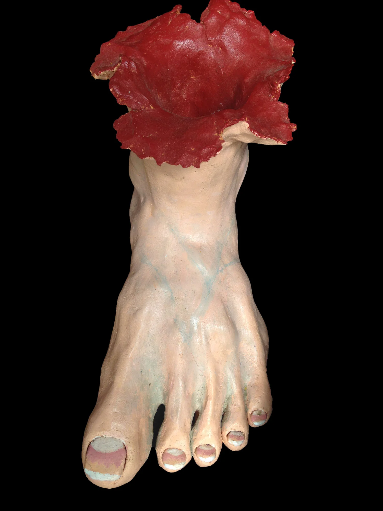 laura-asherman-my-poor-foot.jpg