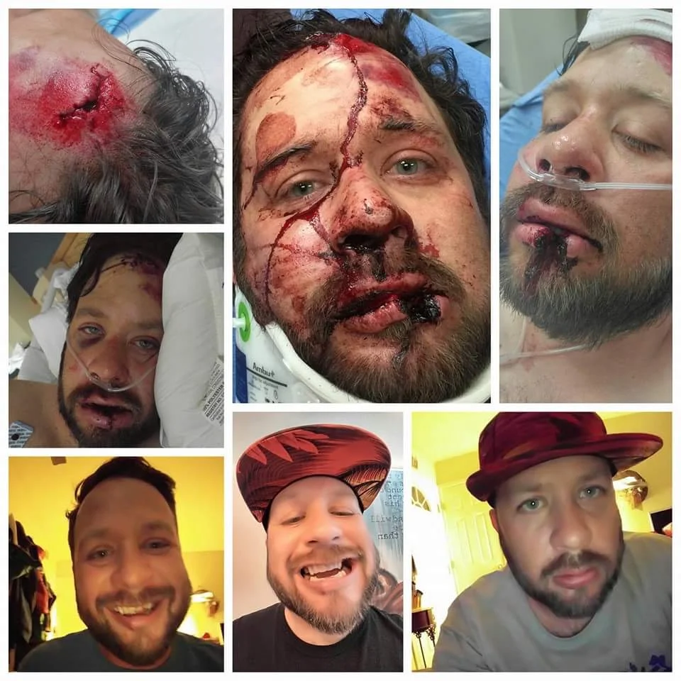 The recovery Adam "Dent" Martinez has made in the past month is miraculous.
