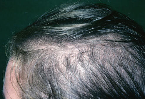 photo credit: HealthOn